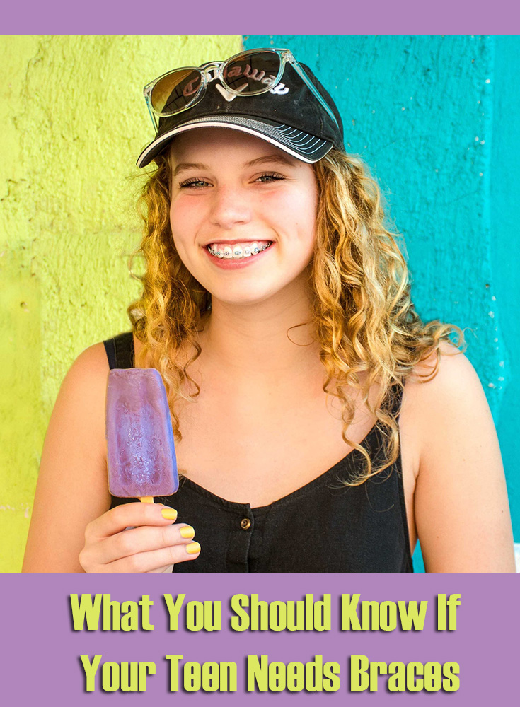 What You Should Know If Your Teen Needs Braces