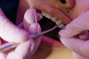 Orthodontics For Children: What To Expect
